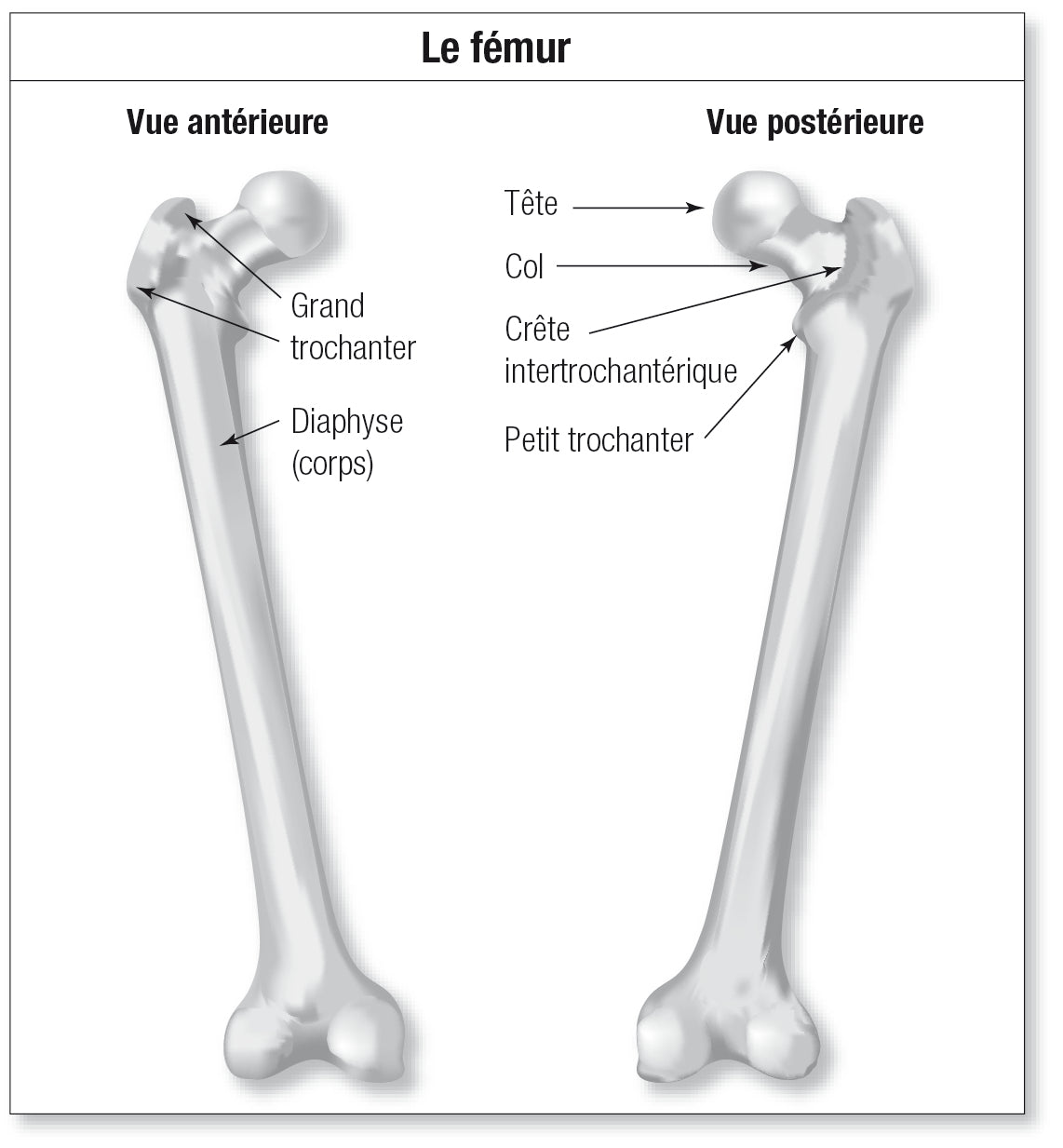 Qu'est-ce qu'une fracture atypique du fémur ?