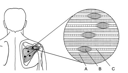 Trigger points : comment les masser ?