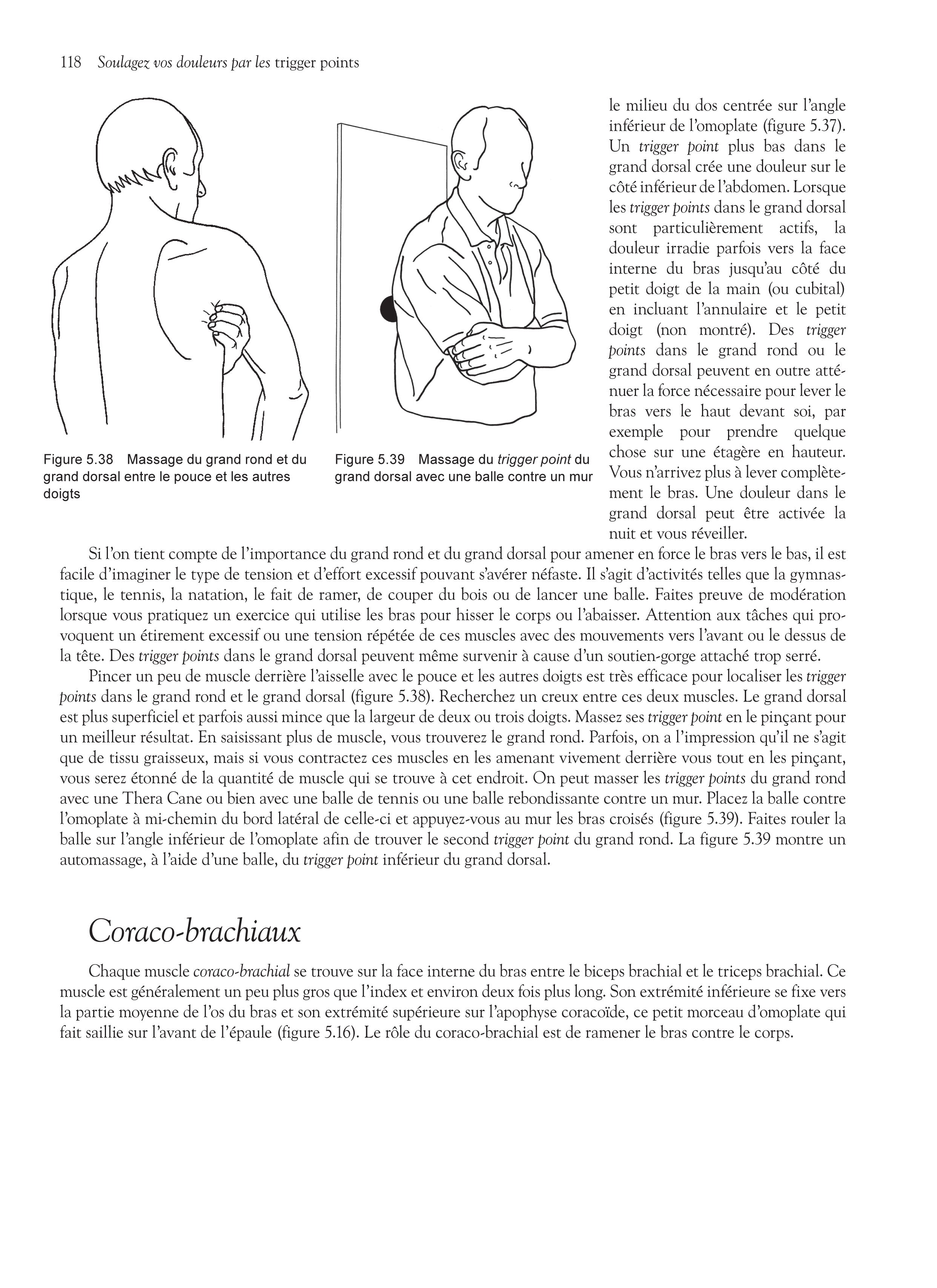 Soulagez vos douleurs par les trigger points