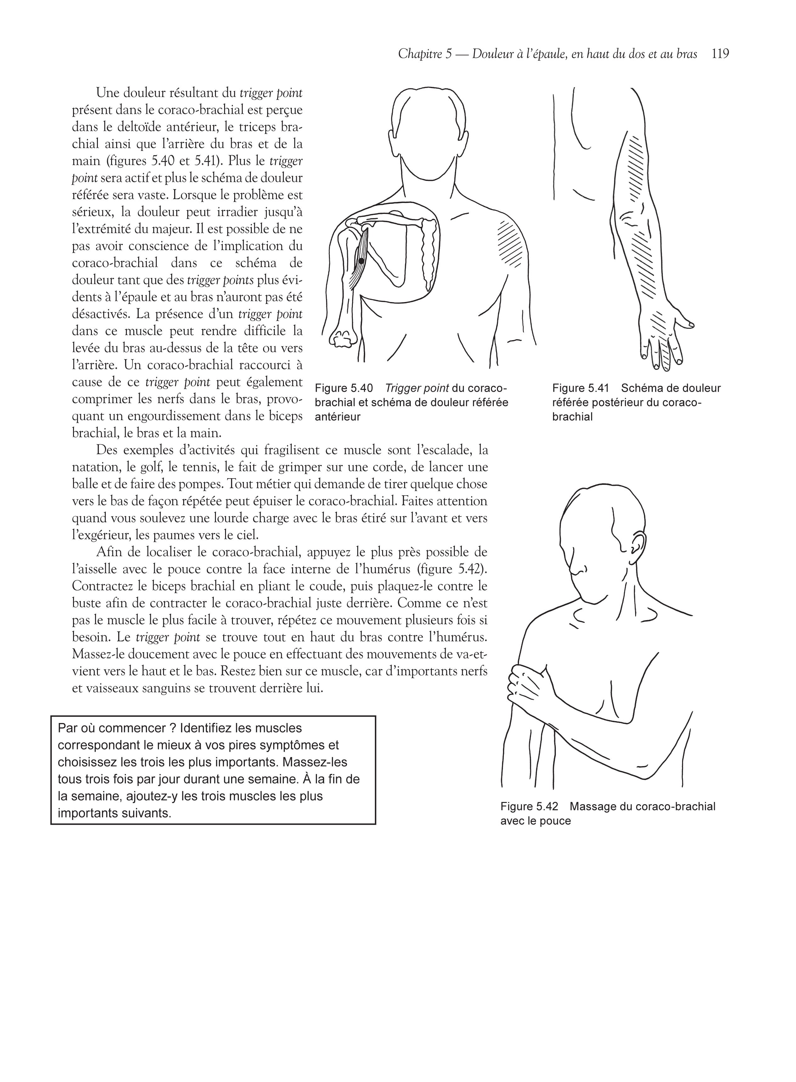 Soulagez vos douleurs par les trigger points