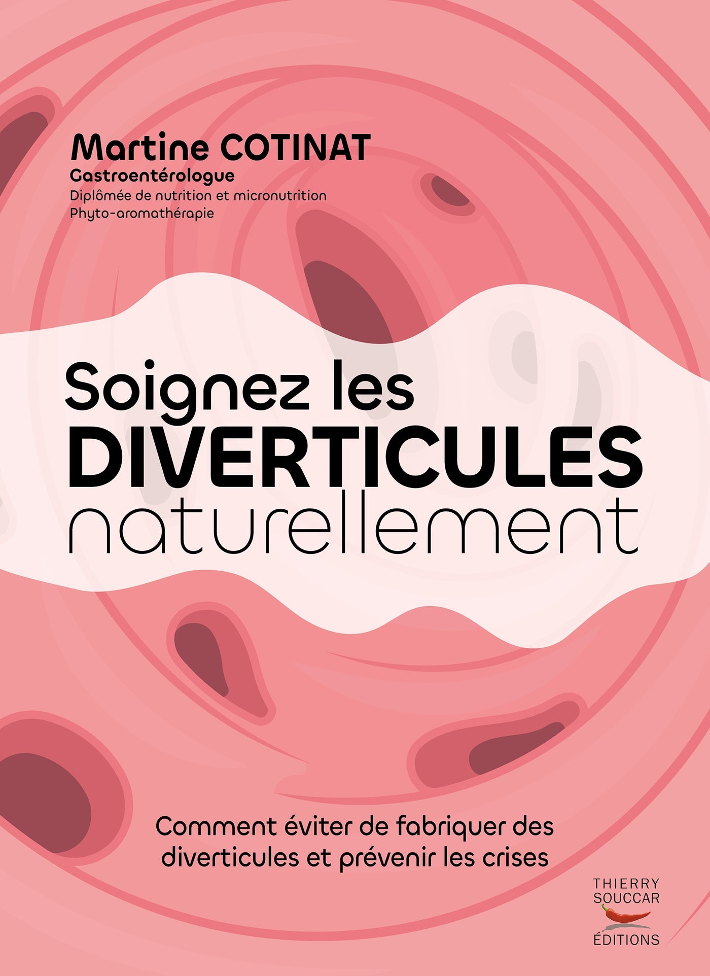 Soignez les diverticules naturellement Martine Cotinat